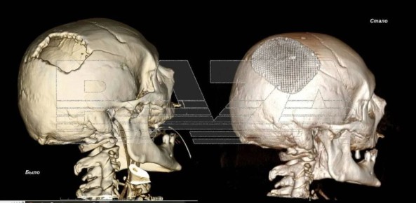 ����� ������������ ����� �������, ������� ������� ������ ��������� �����